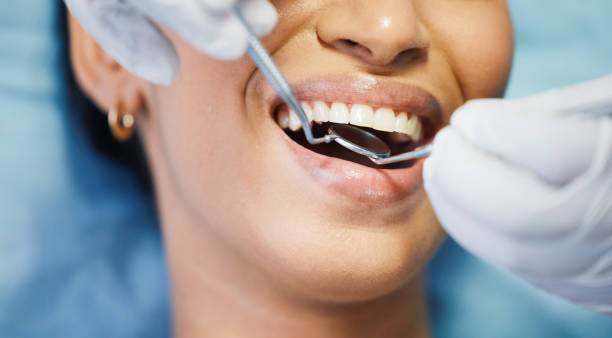 Best Emergency Tooth Extraction in Orcutt, CA